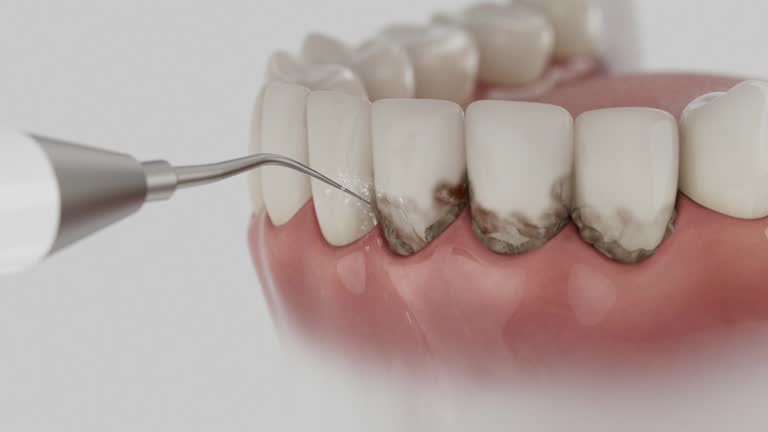 Trusted Invisalign Clear Aligners service in Franklin, NH - Dentist Open Now